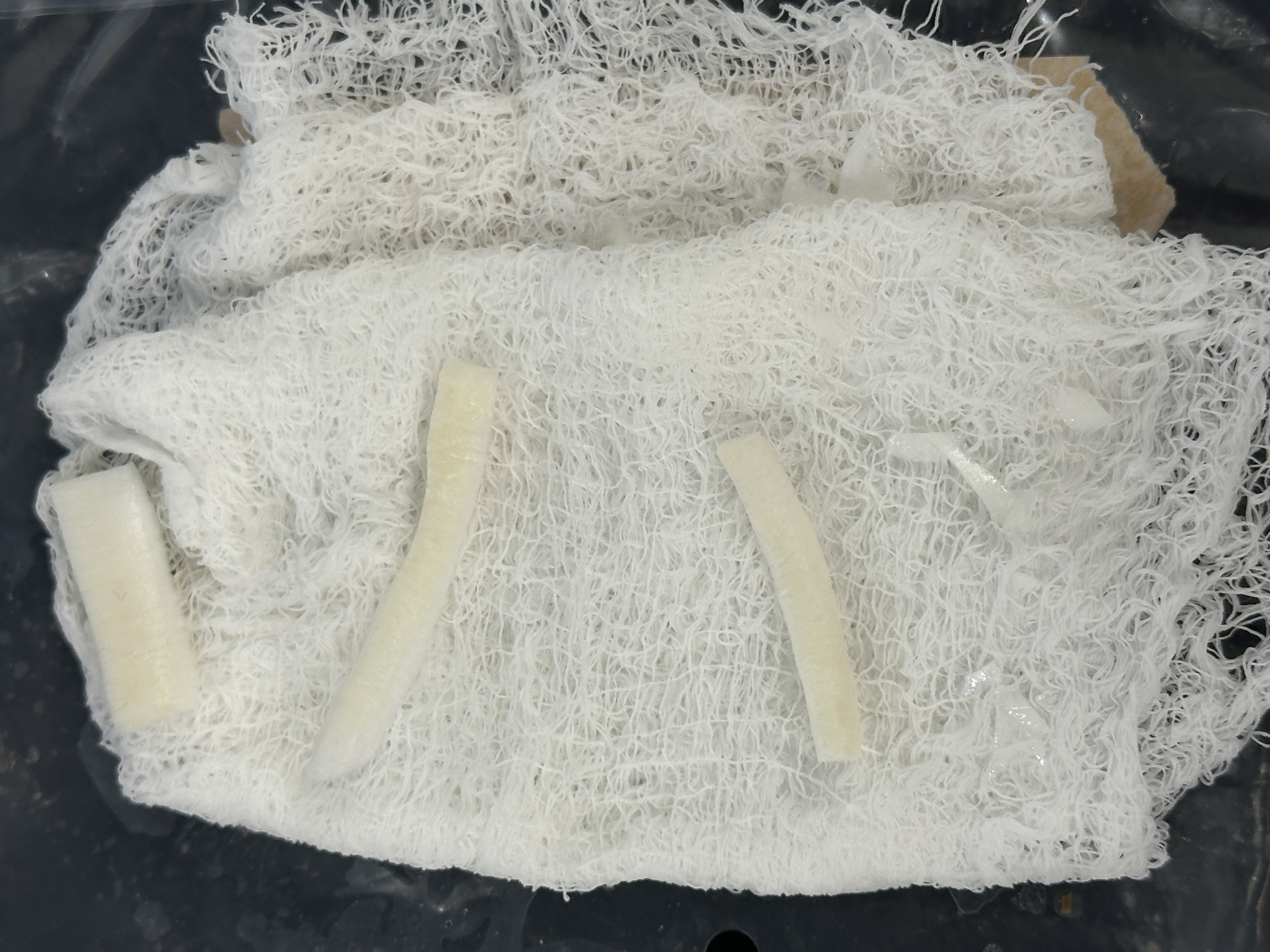Extearna costal cartilage allograft